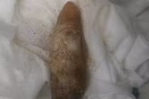 San hô hình... tay người chết gây nhầm lẫn cho cảnh sát