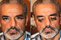 Người đàn ông Ukraine có lông mi dài nhất thế giới?