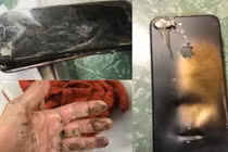 Video: iPhone XS Max đột nhiên phát nổ ngay trong túi quần