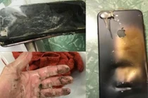 Video: iPhone XS Max đột nhiên phát nổ ngay trong túi quần