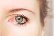 Video: Kinh hãi 11 con giun lúc nhúc trong mắt bé trai 5 tháng tuổi