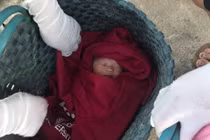 Trẻ sơ sinh bị bỏ rơi, côn trùng cắn chi chít trên mặt