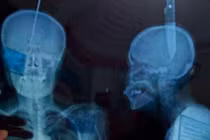 Video: Kinh dị người đàn ông tự đâm dao xuyên đầu để...thở tốt hơn