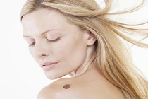 Đoán chuẩn vận mệnh qua những dấu hiệu đặc biệt trên lưng 