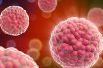 Người đẹp “chân dài” dễ bị ung thư