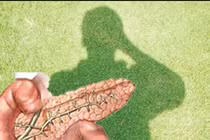 Phương pháp mới, rẻ tiền phát hiện ung thư tụy