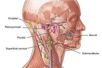 Ung thư hạch không di truyền