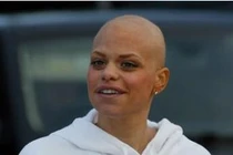 Những ngôi sao phải “chào thua” bệnh ung thư