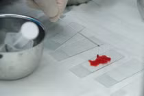 Chẩn đoán bệnh hô hấp dễ dàng hơn với phương pháp mới