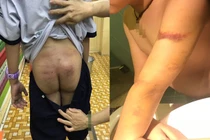 Bé trai nghi bị bố bạo hành ở TP HCM: Cuộc chiến "đòi con" của mẹ đẻ có thành?