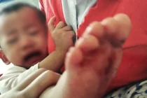 Bé gái bị bỏng nước sôi ở trường học: Tạm đình chỉ trường mầm non