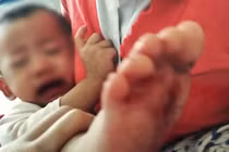 Bé gái bị bỏng nước sôi ở trường học: Tạm đình chỉ trường mầm non