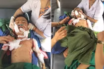 Kinh hoàng bé trai 7 tuổi bị chó cắn tử vong