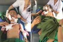 Kinh hoàng bé trai 7 tuổi bị chó cắn tử vong