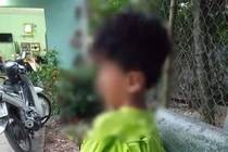 Học sinh lớp 1 bị cô giáo đánh tím bầm người, Bộ GDĐT yêu cầu xác minh