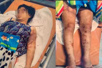 Cô gái 18 tuổi bị tra tấn sẩy thai ở TP HCM: Khởi tố, bắt tạm giam bị can