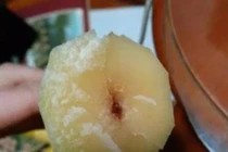 Bệnh nhân suy đa tạng sau ăn mía, vứt bỏ ngay nếu có dấu hiệu này