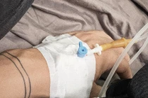 Ca sĩ Đại Nhân bị tai biến ở tuổi 32 cảnh báo triệu chứng đáng sợ