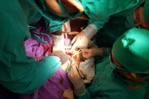 3 năm không điều trị, khối u buồng trứng phát triển thành ung thư