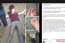 Bác sĩ cảnh báo: Đừng tin cách cấp cứu đột quỵ trên mạng