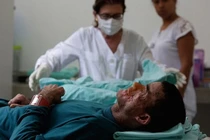 Hoảng loạn bệnh lạ tấn công cơ thể thối rữa dưới nắng