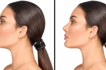 Phẫu thuật cằm cải thiện vẻ đẹp gương mặt như thế nào?