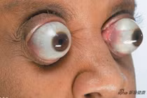 Điểm mặt những dị nhân trên thế giới