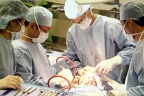 Em bé mắc đồng xu trong thực quản hơn 1 năm