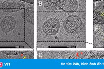 Ảnh hiển vi đầu tiên cho thấy hình dạng thật của virus Corona