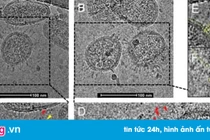 Ảnh hiển vi đầu tiên cho thấy hình dạng thật của virus Corona