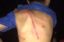 Cha dùng dây điện đánh con 12 tuổi vì lấy trộm thẻ điện thoại nạp game