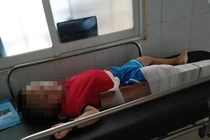 Bé 4 tuổi gãy chân ở lớp, cô giáo nói lý do gây bức xúc