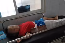 Bé 4 tuổi gãy chân ở lớp, cô giáo nói lý do gây bức xúc