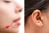 Có 7 nốt ruồi này chứng tỏ bạn số phú quý sung túc cả đời