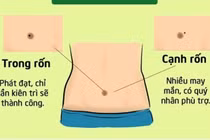 3 nốt ruồi vùng rốn quý như “kim cương”, ai có được sướng trọn một đời