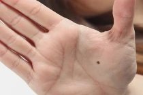 Bàn tay có điểm này không sớm thì muộn cũng thành đại gia giàu khủng 