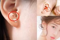 Đứa trẻ có nốt ruồi ở vị trí này là "nam rồng nữ phượng"