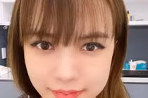 Nghi vấn bạn gái Sơn Tùng M-TP "dao kéo" khi lộ mặt sưng vù