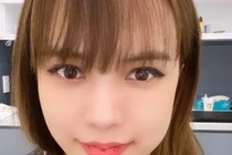 Nghi vấn bạn gái Sơn Tùng M-TP "dao kéo" khi lộ mặt sưng vù