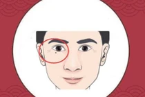 Với 4 nốt ruồi “khó ở” trên cơ thể, cả đời không có tiền