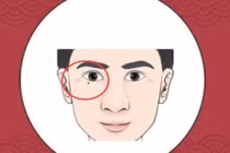 Với 4 nốt ruồi “khó ở” trên cơ thể, cả đời không có tiền