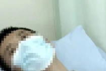 Người đàn ông nôn ra máu vì thói quen khi nắng nóng