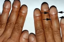 Cách chẩn đoán các bệnh nội tạng, đặc biệt là ung thư 