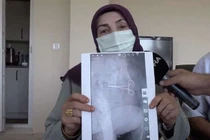 Bụng sưng đau sau phẫu thuật, bà mẹ 7 con tái mặt biết lý do