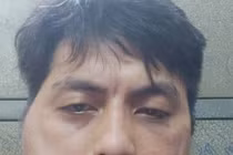 Thanh niên tố bị chủ quán lẩu nướng đánh đập biến dạng khuôn mặt