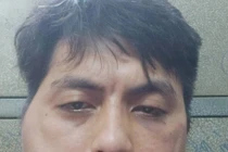 Thanh niên tố bị chủ quán lẩu nướng đánh đập biến dạng khuôn mặt