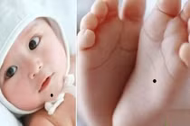 Trẻ có 4 nốt ruồi này trên người cha mẹ tha hồ mừng to