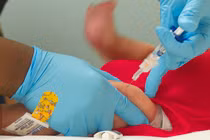 Căn bệnh bị xóa sổ cách đây 50 năm tái xuất ở Mỹ