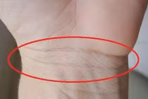 Nhìn 3 giây vào đường ngấn cổ tay sống thọ hay yểu mệnh