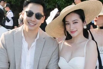 Trương Tri Trúc Diễm mắt lồi, mặt sưng vì bị bệnh cường giáp